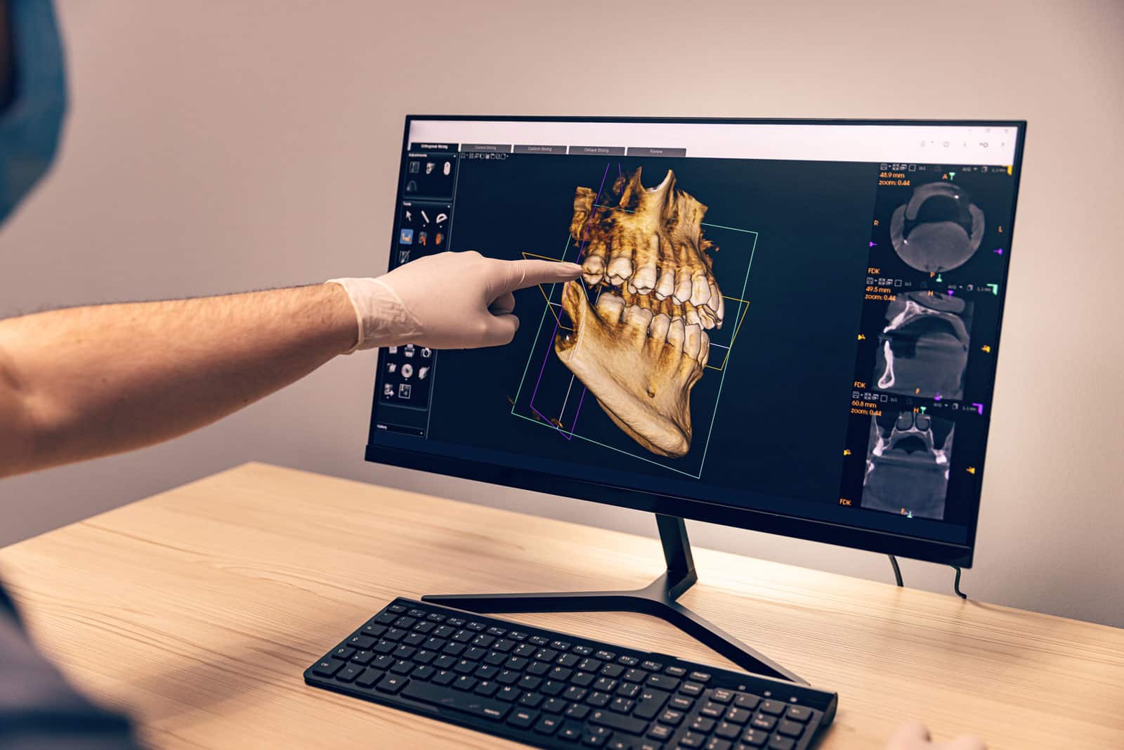 A dentist examines a dental X-ray on a computer screen, showcasing the integration of technology in dental care