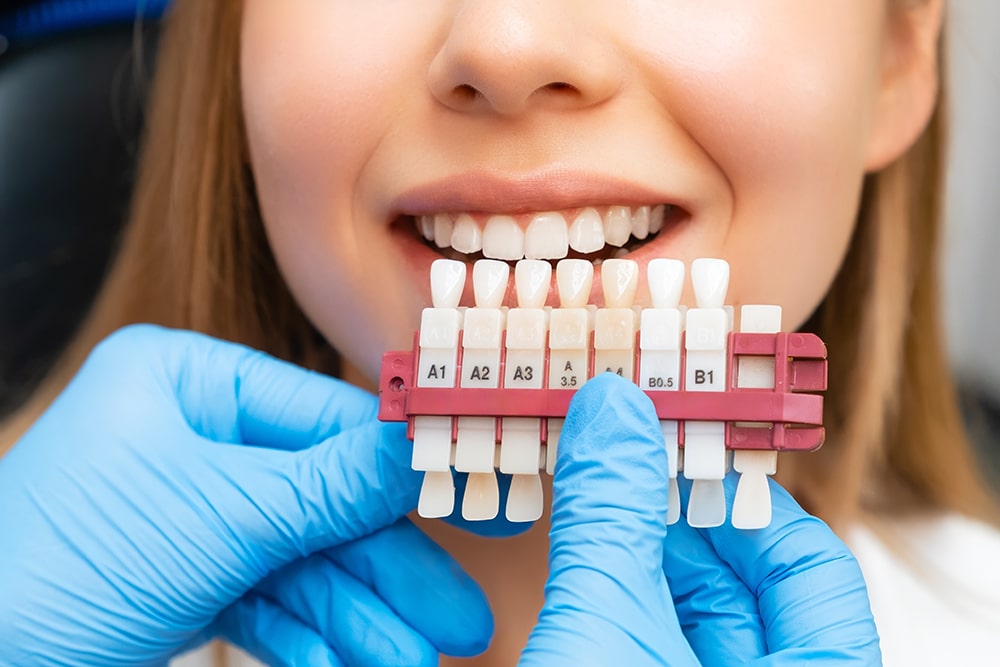 A dentist holding a dental veneers color guide to match and compare with a patient's teeth for cosmetic dentistry treatment