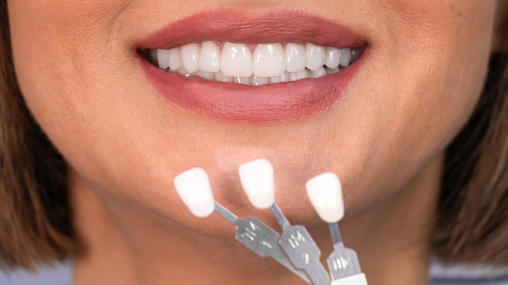 A woman is holding a shade guide for her teeth, emphasizing personal care and oral hygiene