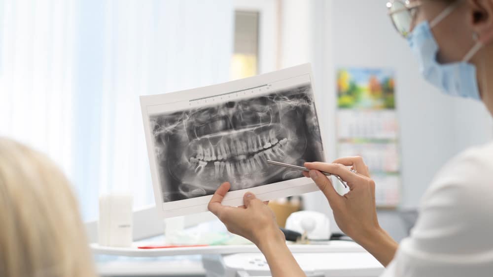 A dentist carefully examining a dental X-ray, focusing on areas related to sinus lifts and overall oral health assessment