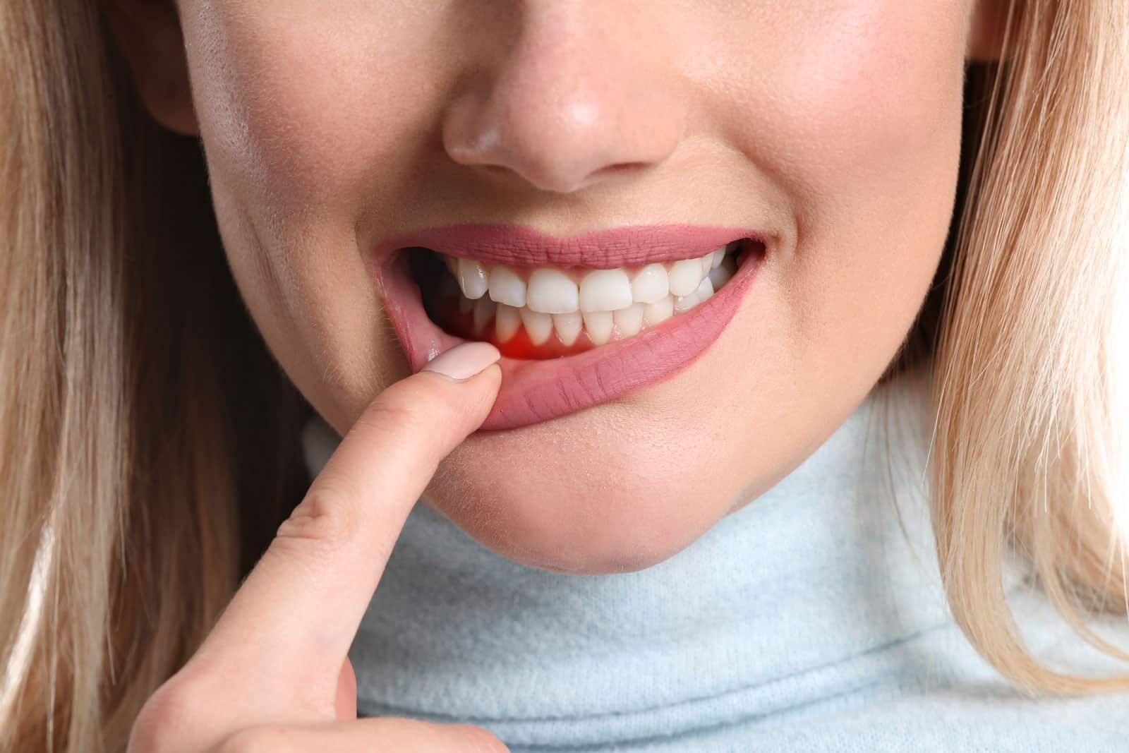 A woman with red teeth engages in brushing her teeth, highlighting the importance of periodontal therapy for oral health